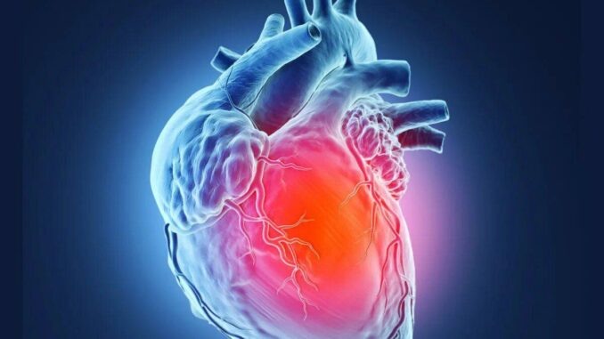 УЗИ, МРТ или КТ сердца? Подробная инструкция: что вам назначили и что на самом деле видит врач