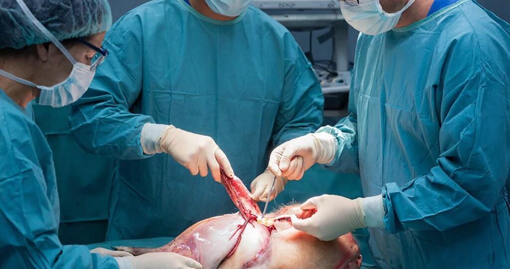 Внутренние органы свиньи для трансплантации человеку