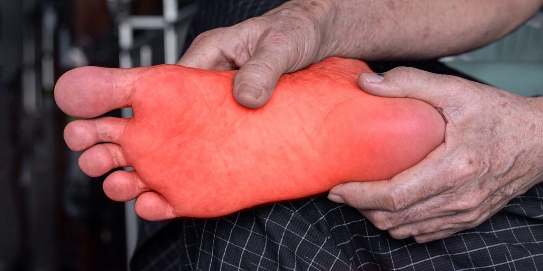 Жжение в стопах ночью: скрытая проблема нервов