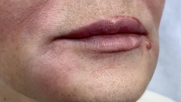 Поджелудочная на грани, а мы не чувствуем: 3 тревожных сигнала у людей пожилого возраста