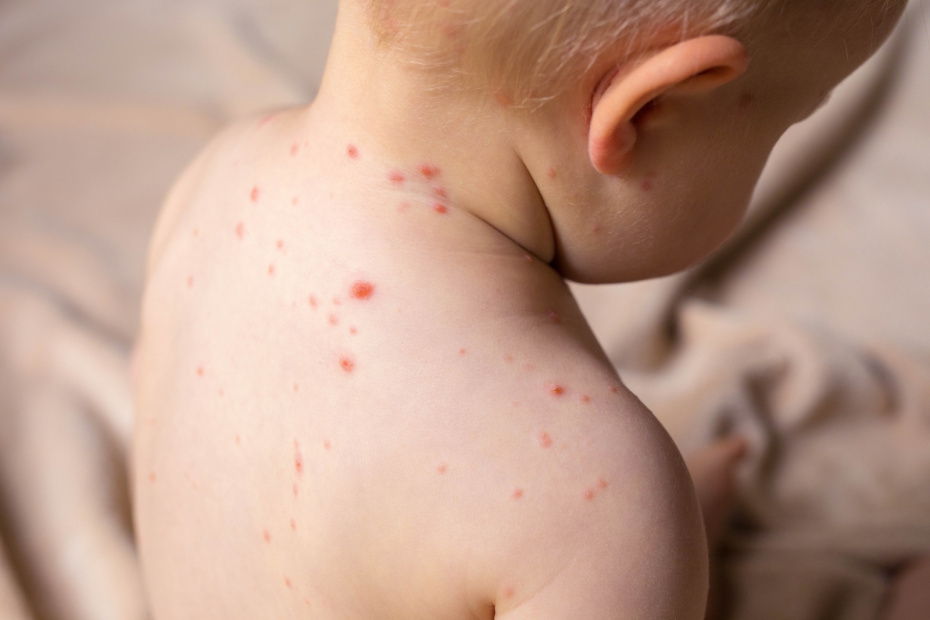    Shutterstock/FOTODOM