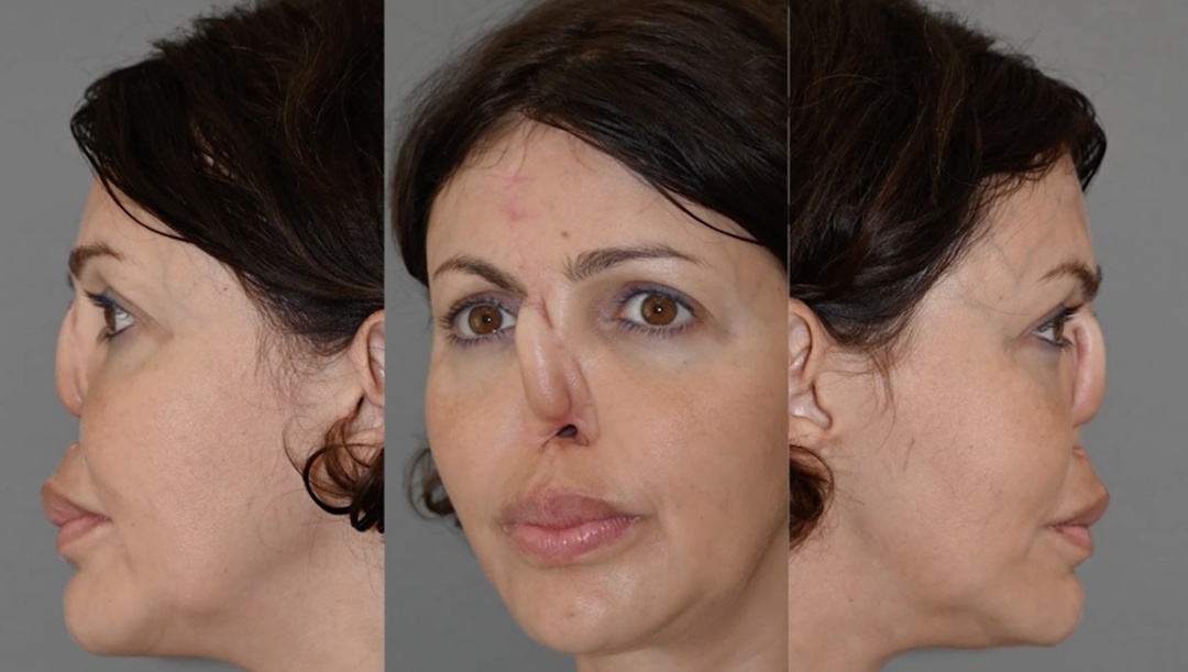 Фото: Телеканал «Пятница!» 