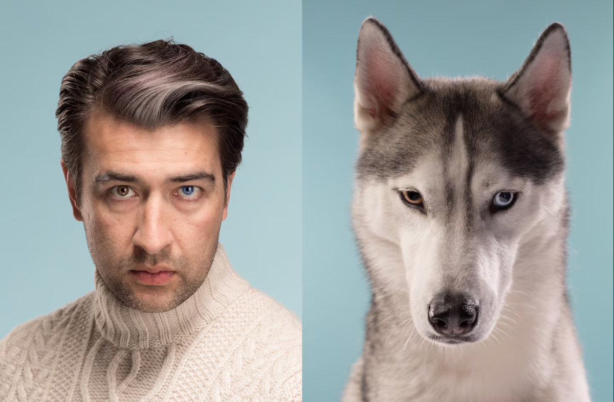 У обоих гетерохромиея - генетическим заболеванием, при котором глаза имеют разный цвет.