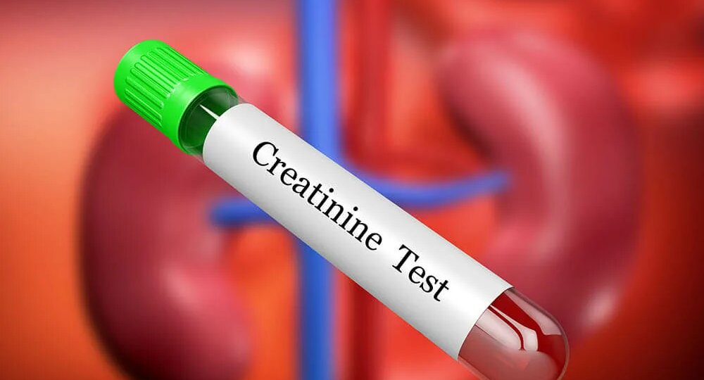 Все про креатинин и почему его уровень так важен для здоровья