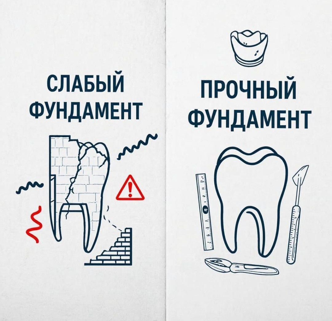 «Разрушенный зуб — ненадёжная опора»