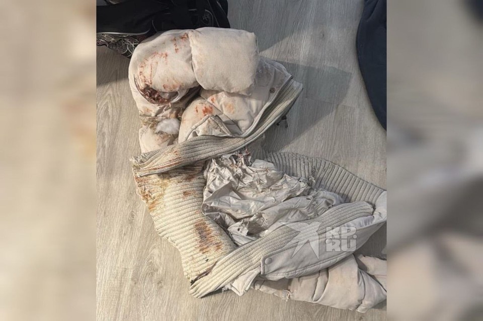    Верхнюю одежду моментально разъело агрессивной жидкостью. Фото: предоставлено пострадавшей