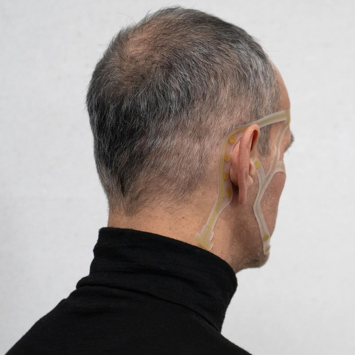 Электродные массивы с гибкой печатью, такие как у Института цифровых медиатехнологий Фраунгофера, предлагают удобный вариант для сбора высококачественных ЭЭГ-сигналов