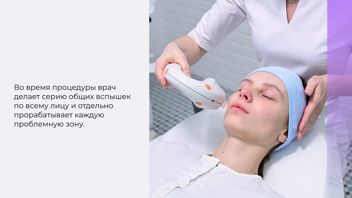 Лазерная косметология на аппарате М22