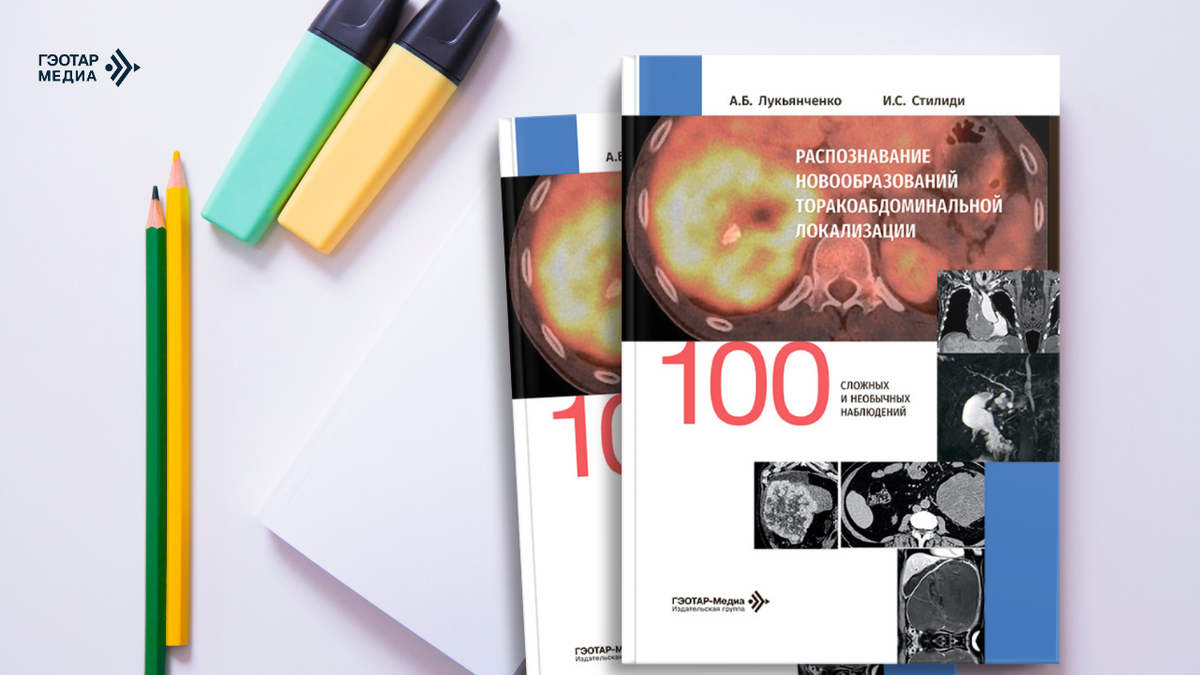 Распознавание новообразований торако-абдоминальной локализации. 100 сложных и необычных наблюдений, Лукьянченко А.Б., Стилиди И.С.