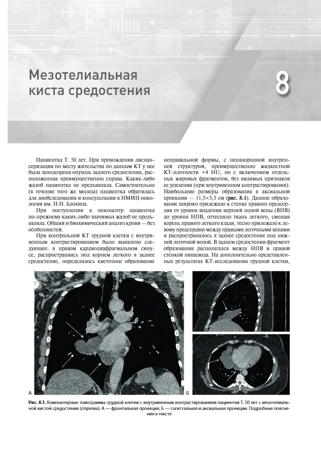 Страницы книги "Распознавание новообразований торако-абдоминальной локализации. 100 сложных и необычных наблюдений"