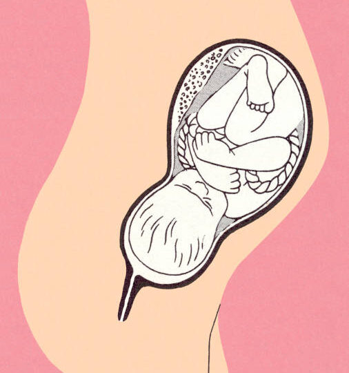 Почему в роддоме погибло 9 младенцев