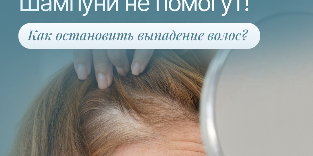 Почему шампуни «от выпадения волос» обычно не работают?