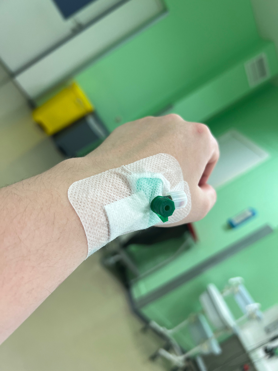 Катетер поставили в кисть, так как Вены было сложно найти в привычном месте.