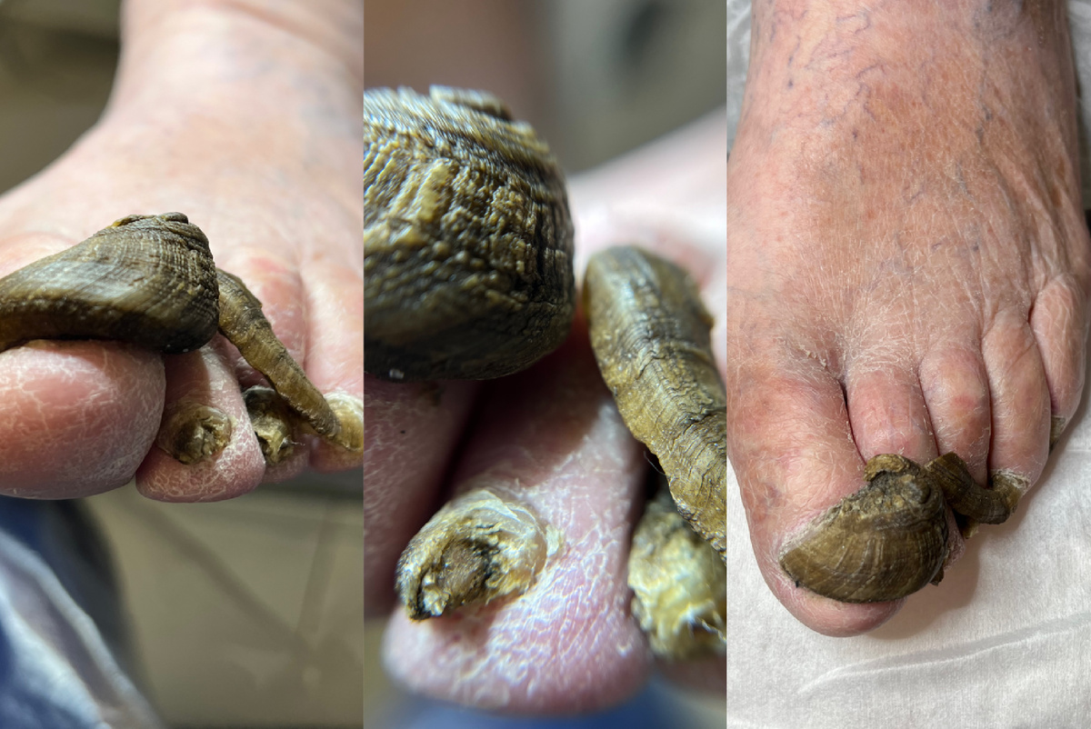 Ногти до приема 