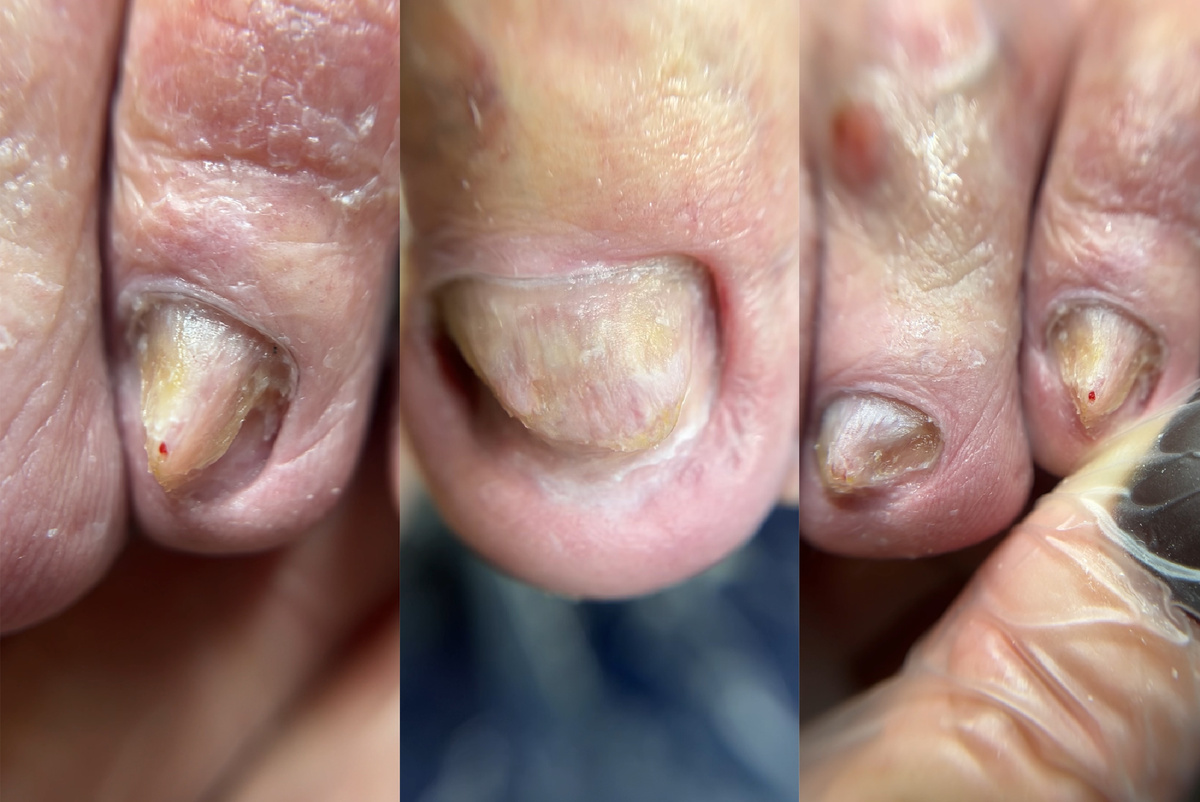 Результат сразу после приема 