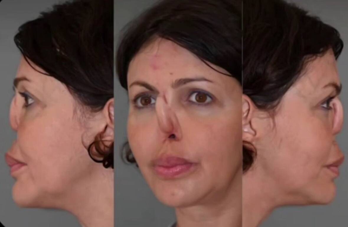 фото: соцсети 