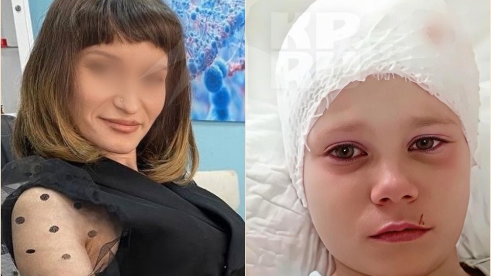 Хозяйка овчарки, сорвавшей скальп с 7-летней девочки в Хакасии, заявила на всю страну: «Мой пес – просто дружелюбный дурачок!»