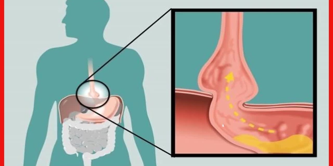 Этот симптом в желудке часто упускают из виду