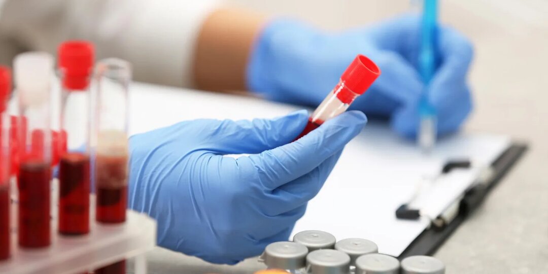 Как расшифровать анализы при жировой болезни печени и вовремя принять меры