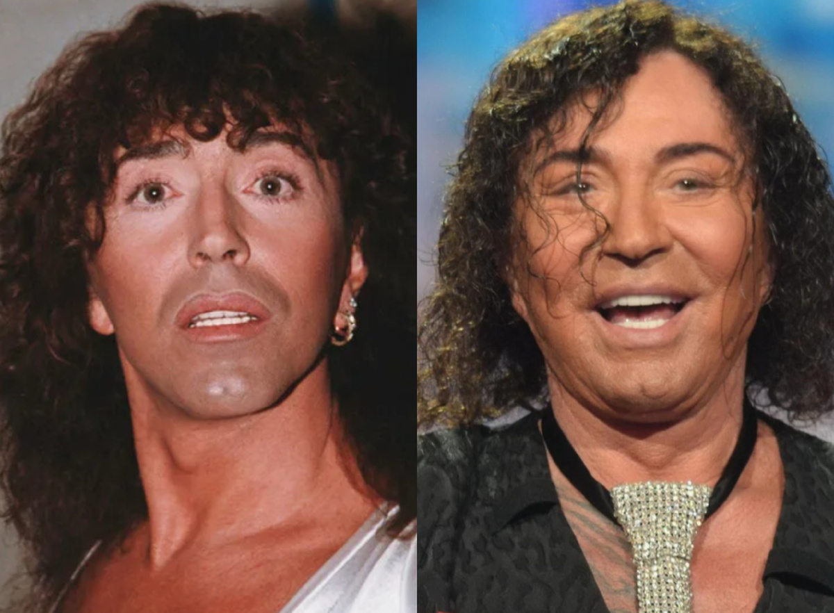 на фото Валерий Леонтьев до и после пластики