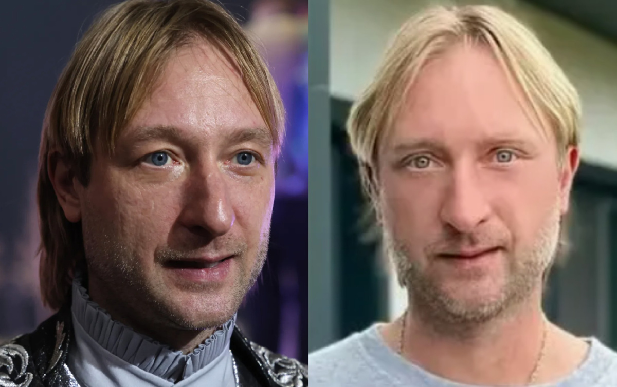 на фото Евгений Плющенко до и после пластики