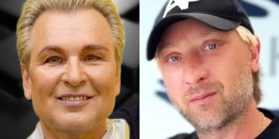 Пластиковые мужчины: 7 звёздных мужчин, которые чересчур увлеклись пластикой