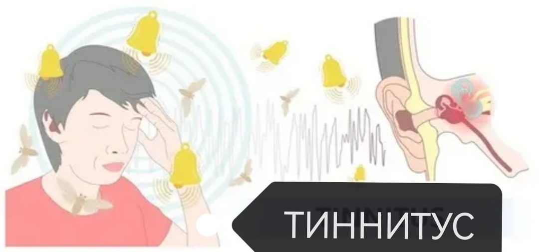 Почему изматывает шум в голове? Страдающий этим недугом поймёт.