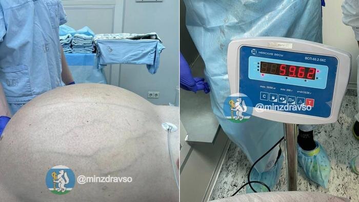 Обложка © Минздрав Свердловской области