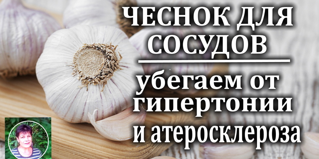 Чеснок для сосудов: моя печальная история, личный опыт и выводы
