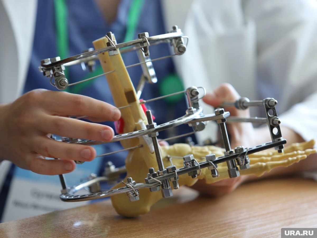     Уникальная операция прошла в курганском Центре Илизарова (архивное фото)