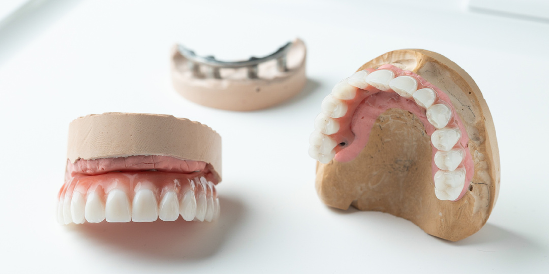 Протезы для пациентов с выраженным рвотным рефлексом: как адаптировать лечение ☝