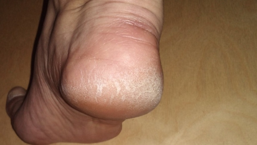 Застой желчи видно по ногам: возрастные признаки, которые мы зачастую упускаем из вида