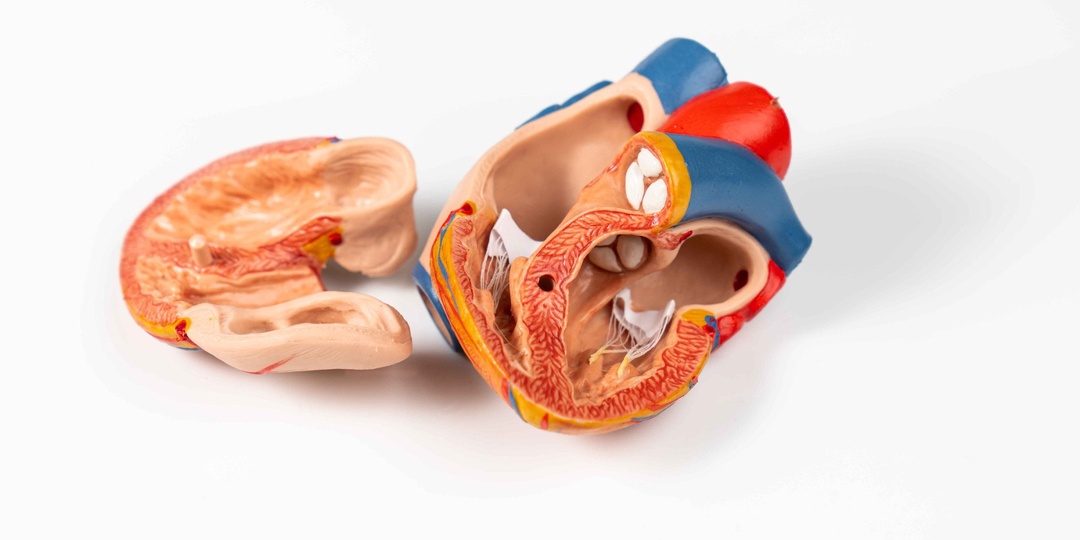 В журнале Circulation описан случай выполнения транскатетерного коронарного шунтирования