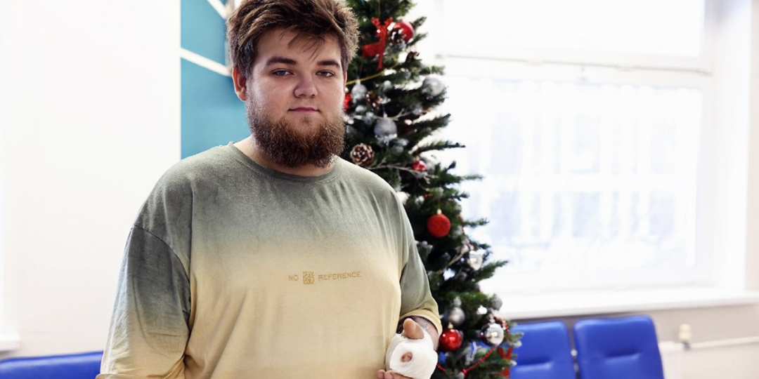 Пациента ГКБ Юдина спас товарищ, найдя дома его палец, отчлененный домкратом