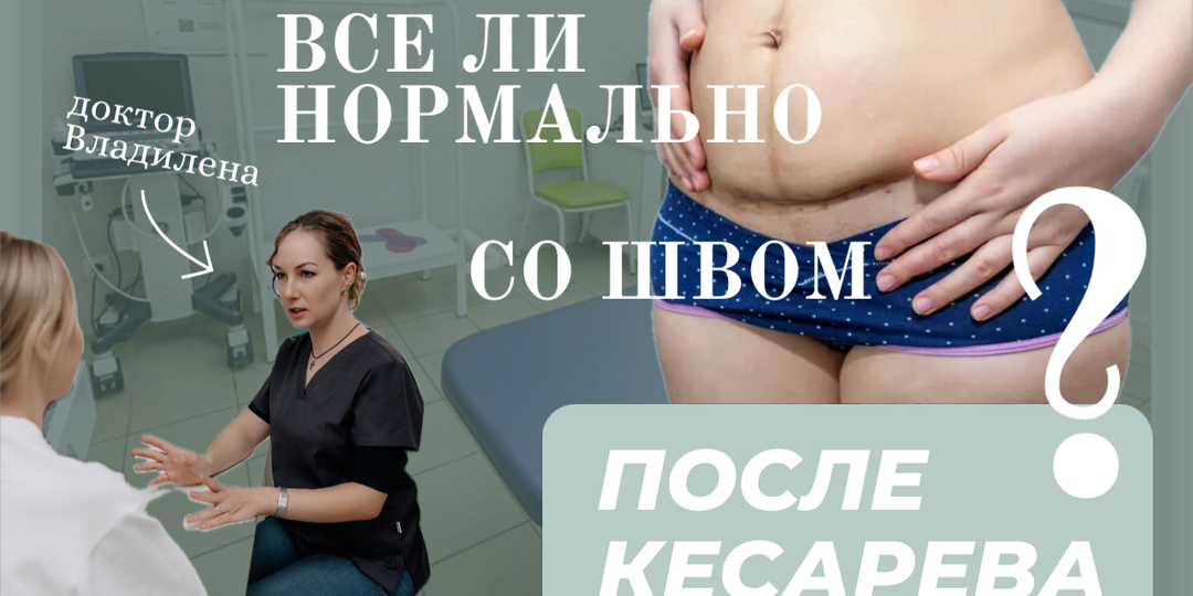 Что-то не так со швом после кесарева сечения?