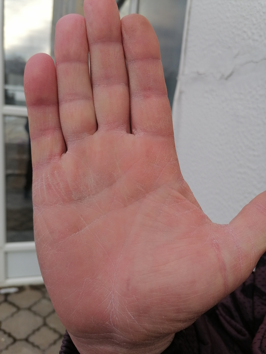 Правая ладонь. Фото автора.