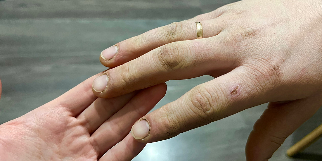 Ногти выдают жировую печень: 3 признака ожирения и 5 продуктов для очищения у пожилых