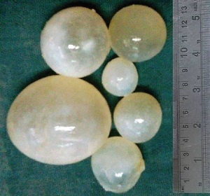 Фото: gelmintoz.net