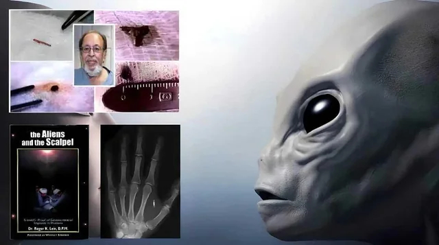 Что скрывается под кожей: история хирурга и странных "имплантов"