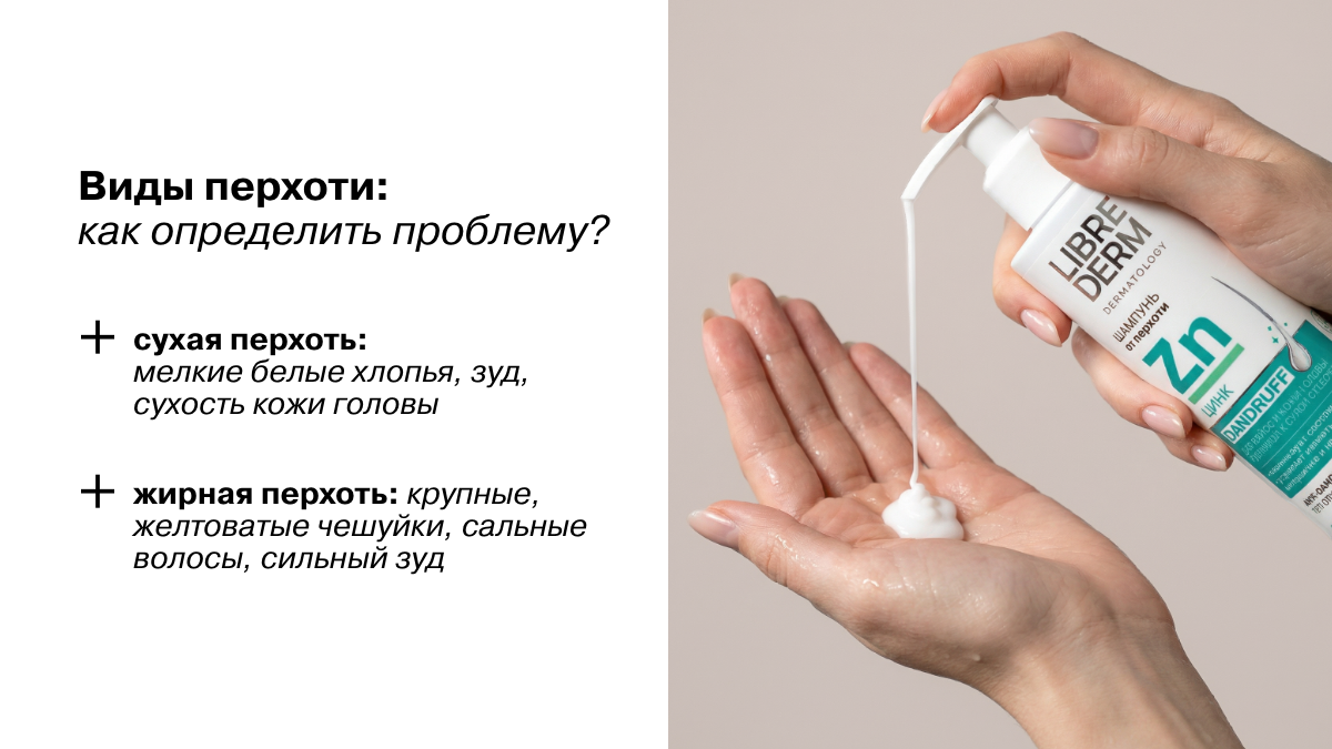Виды перхоти: как определить проблему?