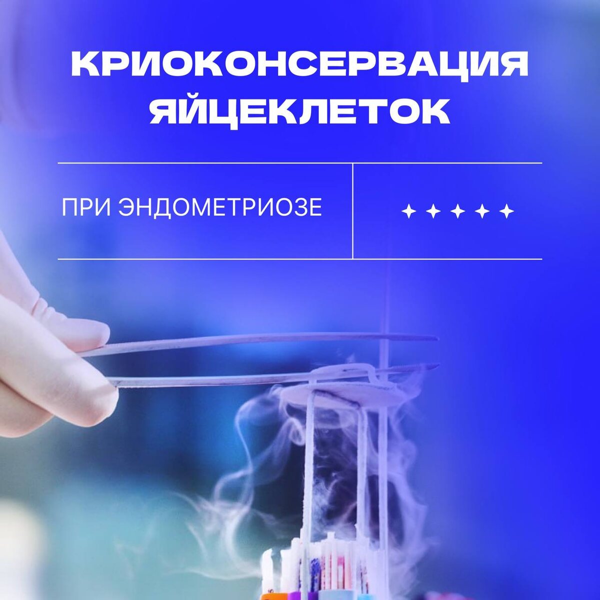 Криоконсервация яйцеклеток