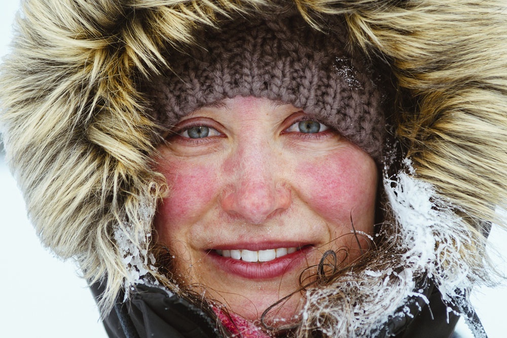    В зимний период кожа становится более чувствительной к внешним воздействиям, поэтому необходимо скорректировать уход, чтобы сохранить ее естественную защиту. / iStock