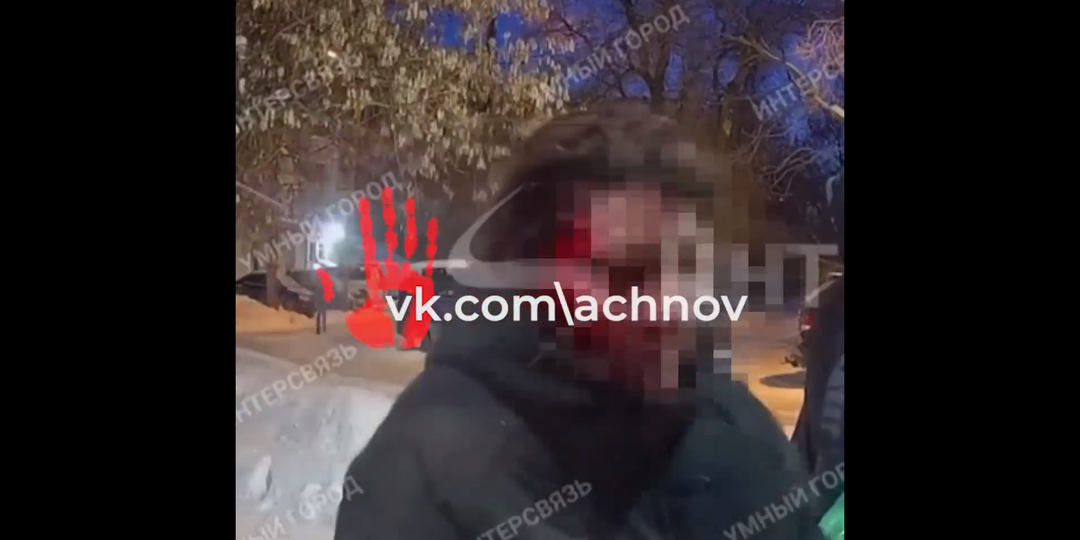 "Больно у тебя кровь идёт! Кто-нибудь, кто-нибудь помогите моей маме!"