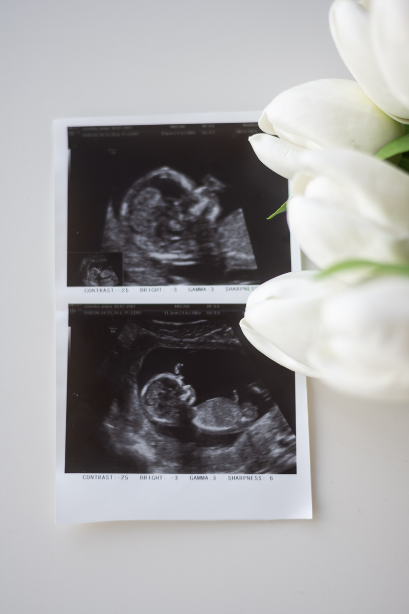 фотосессия беременности в студии. Лучше всего проводить съемку с 27 по 34 недели. Когда еще животик аккуратный и не большой. С соьой можно взять узи малыша, пинетки, цветы, распашонку.