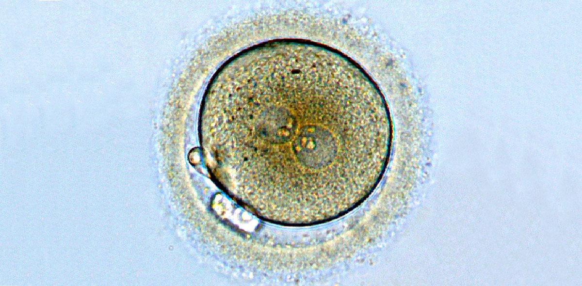 Человеческая зигота: первый день развития эмбриона. Видны женское и мужское ядра, полярное тельце