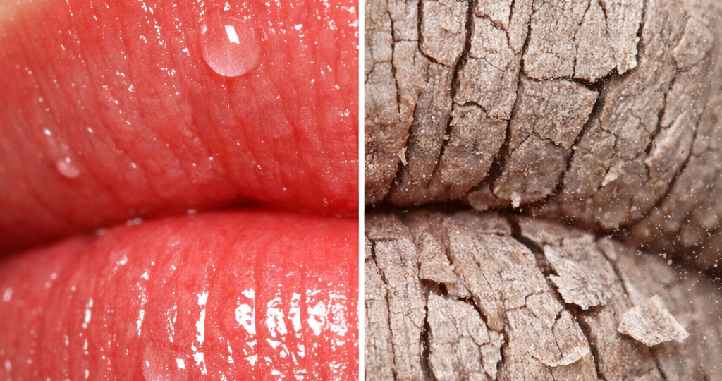 Хейлит зимой: почему трескаются губы и как действительно им помочь 💋❄️Дерматолог Анна Журавлева