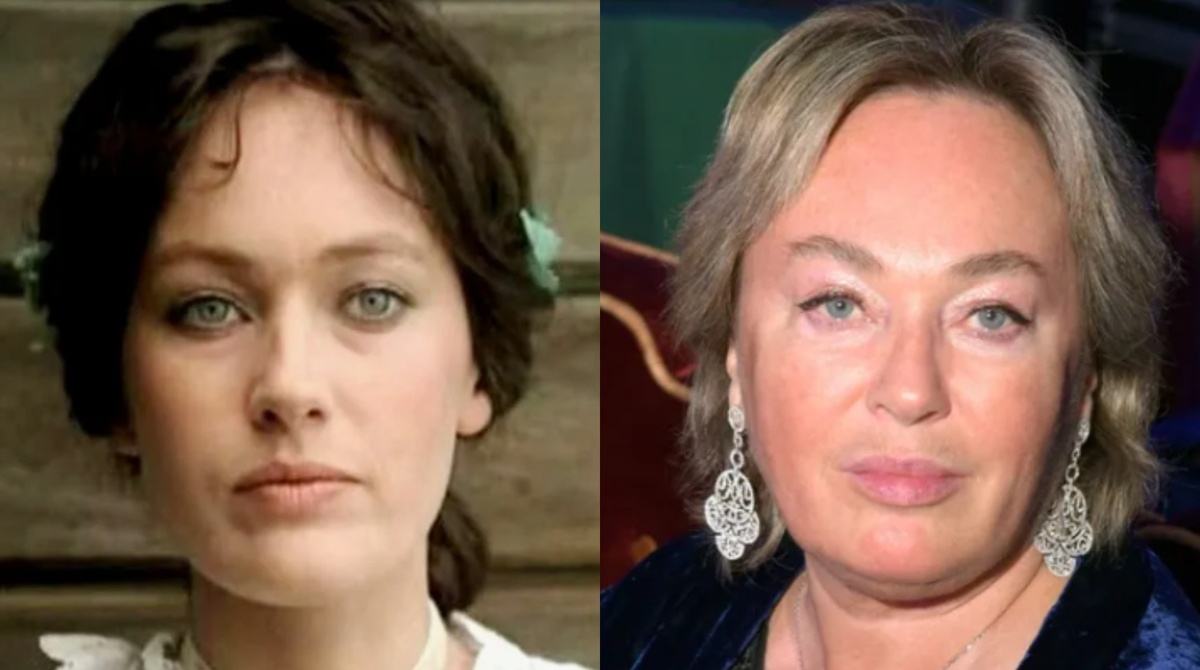 на фото Лариса Гузеева до и после пластики