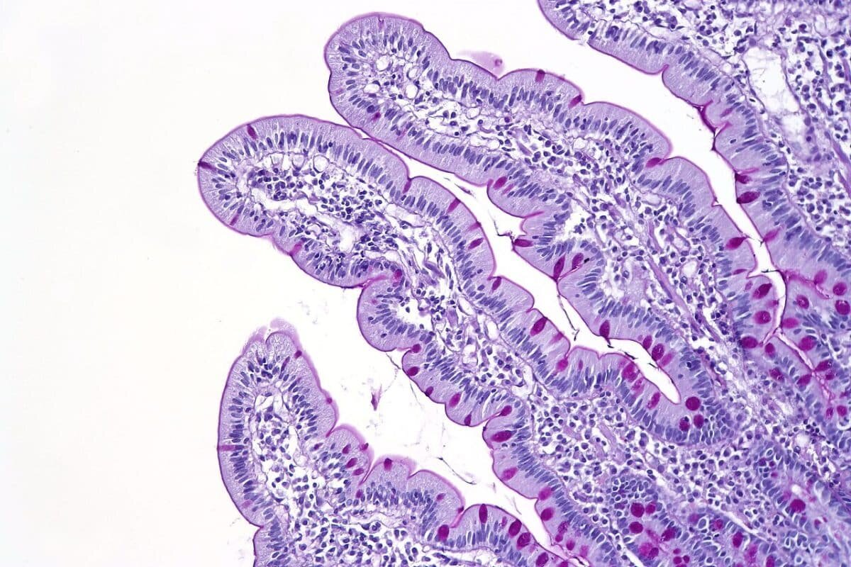    Ворсинки в двенадцатиперстной кишке / © CoRus13