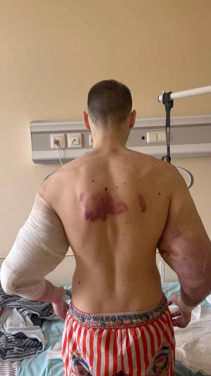    Удалить вазелин из тела блогера можно только с руками. Фото: Личная страница героя публикации в соцсети