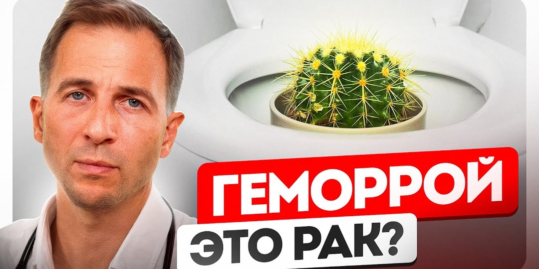 Геморрой: признаки у мужчин и женщин + ранние предупреждения